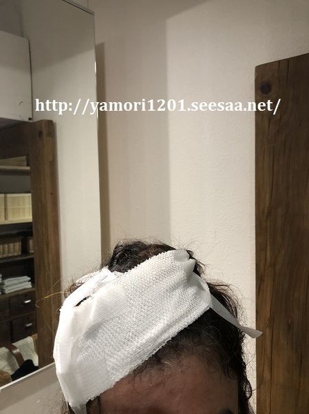 頭の怪我.jpeg